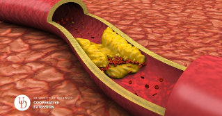 a digital image of an artery with cholesterol